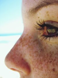 Cropped image of person with freckles