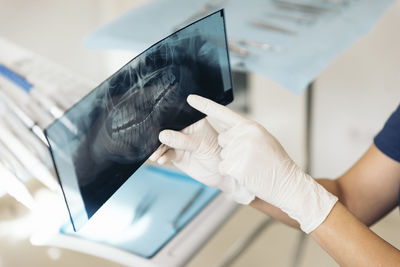 Cropped hands of dentist examining x-ray