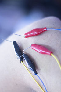 Cropped image of patient with medical needles on body part