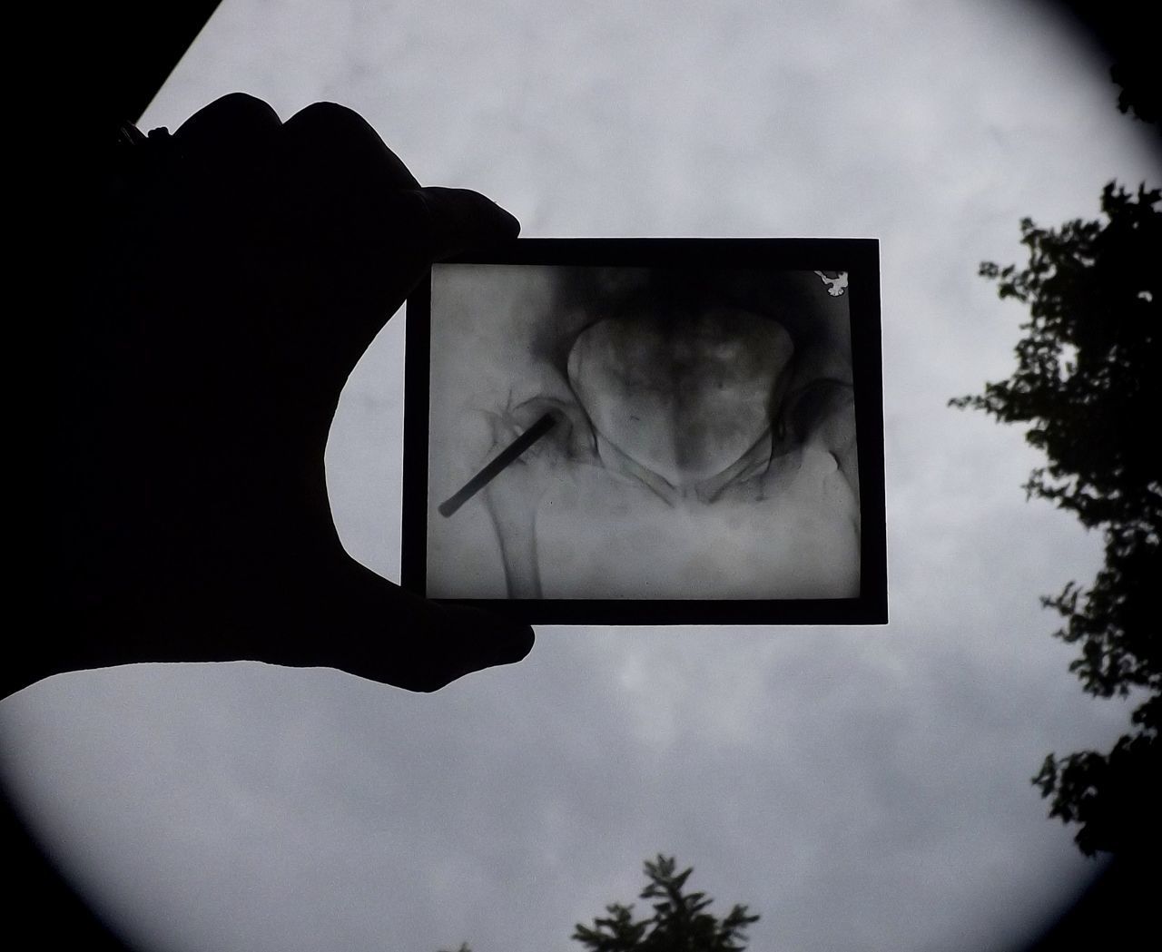 LOW ANGLE VIEW OF HAND PHOTOGRAPHING THROUGH TREE AGAINST SKY