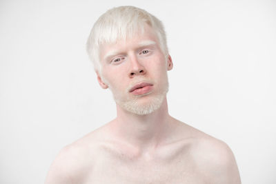 Portrait of shirtless young man with albino against white background