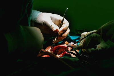 Cropped image of doctors doing surgery of patient in operating room