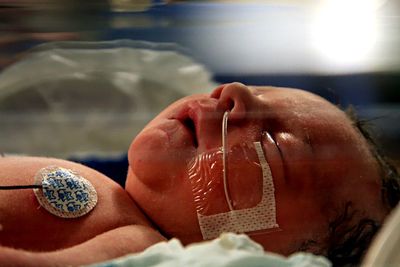 Newborn in hospital incubator. 