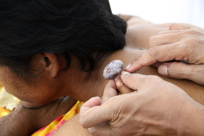 Close-up of man with skin disease