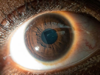 Close-up of human eye