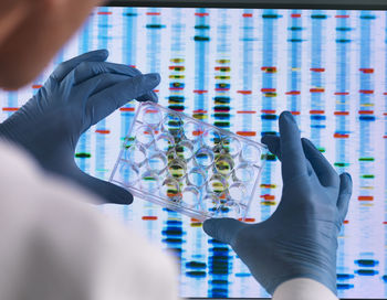 Scientist holding a multi well plate used for genetic testing with the results on a computer sceeen in a laboratory