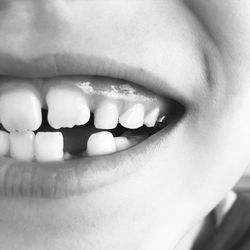 Close-up of child losing milk teeth