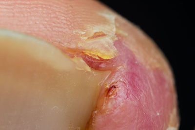 Close-up of ulcer on dog skin