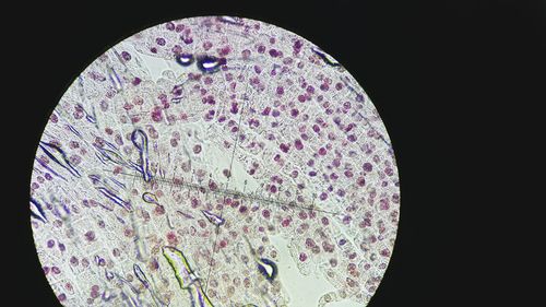 Microscopic image of tissue