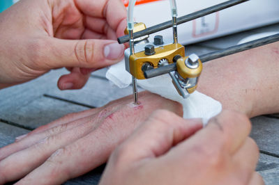 Cropped image of surgeon operating hand on table