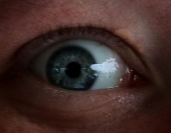 human eye