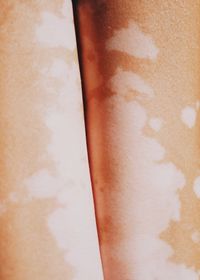 Cropped image of person with skin disease