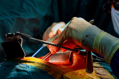 Cropped image of surgeon operating patient