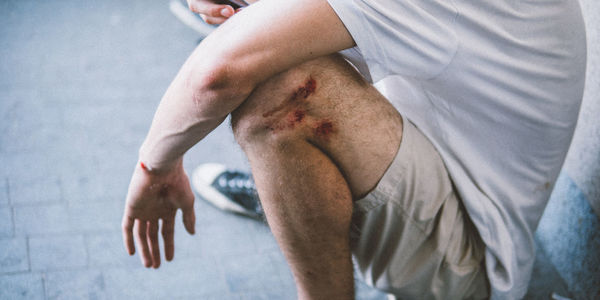 Low section of injured man crouching outdoors