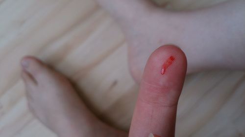 Low section of boy showing blood on finger