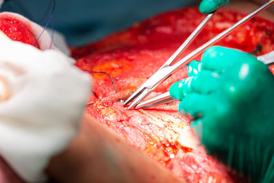 Close-up of surgeon operating patient in hospital