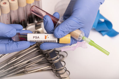 Blood sample with abnormal high psa test result.