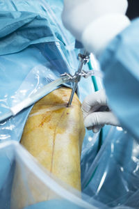 Cropped hands of doctor performing operation on patient knee in hospital