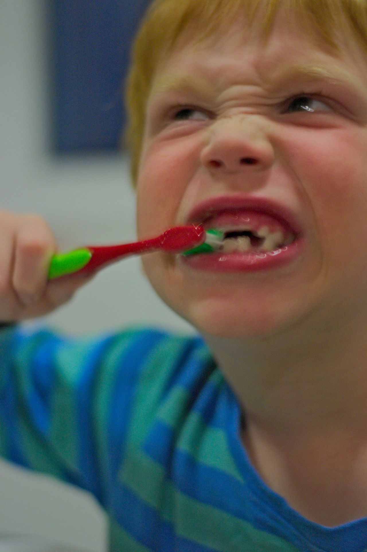 Deciduous tooth