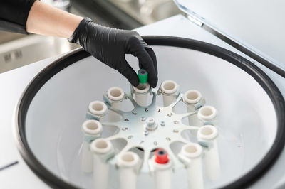 The doctor takes out a test tube with blood plasma from the centrifuge. plasma lifting procedure for