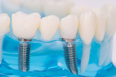 Close-up of artificial teeth at dentist