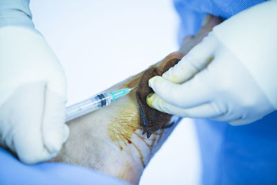 Midsection of doctor injecting syringe on patient foot in operating room