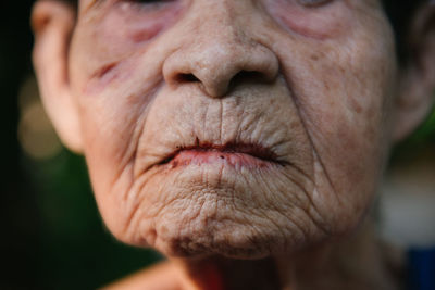 Close-up of woman with scar on cheek