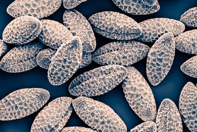 Pollen grains photographed with an electronic microscope
