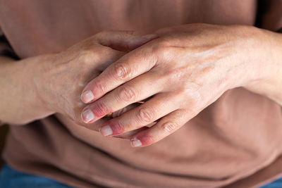 Close up of elder woman hands with atopic dermatitis, eczema, allergy reaction on dry skin