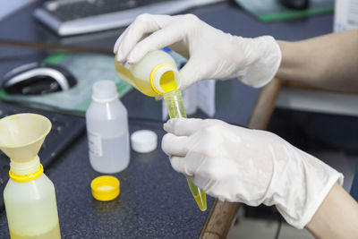 Cropped hands of scientist examining chemical in laboratory