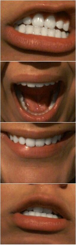 Dientes