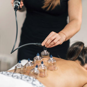 Vacuum therapy. therapist placing transparent glass cups on woman's back