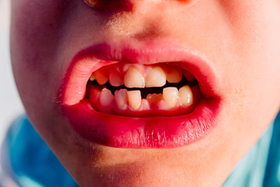 Close-up of boys teeth