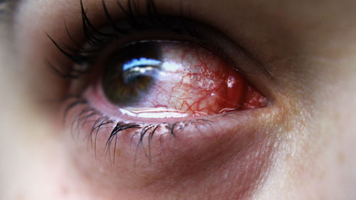 Close-up of human eye