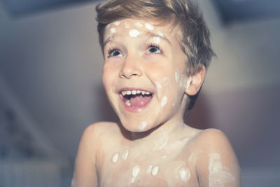 Smiling boy infected with chickenpox 