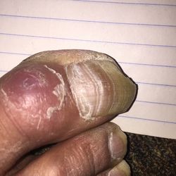 Close-up of cropped hand