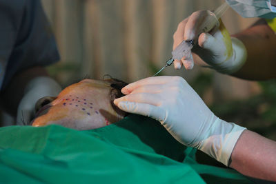 Cropped hands of doctor injecting syringe to patient in operating room