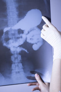 Cropped hands of woman holding x-ray image