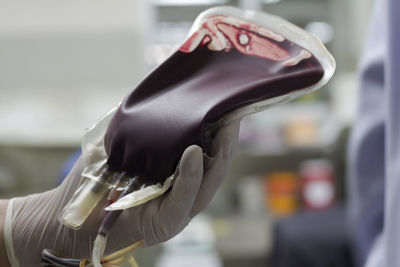 Cropped hand of doctor holding blood bag