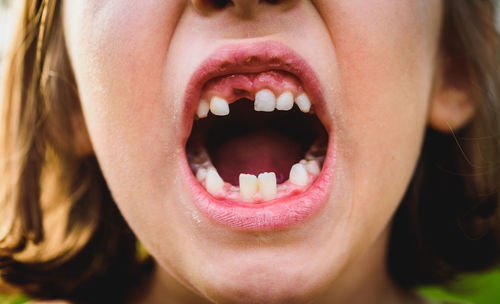 Midsection of girl with gap tooth