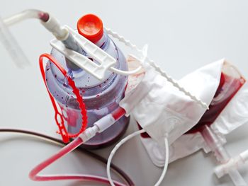 High angle view of blood in containers on table