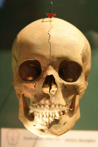 Close-up of human skull