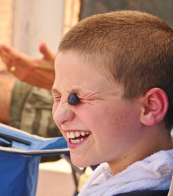 Close-up of smiling teenage boy with blueberry on eye