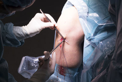 Midsection of surgeon doing knee surgery in hospital