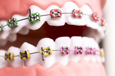 Close-up of dental equipment