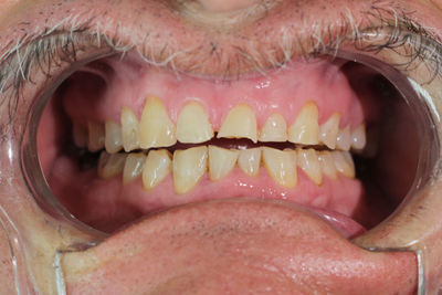 human mouth
