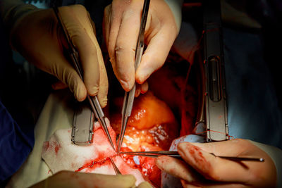 Cropped hands of doctors operating patient in hospital