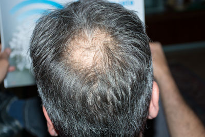 Close-up of balding man