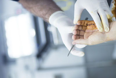 Close-up of doctor stitching patient skin