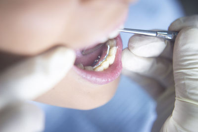 Cropped hands of dentist examining mouth